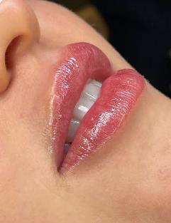 Hidragloss