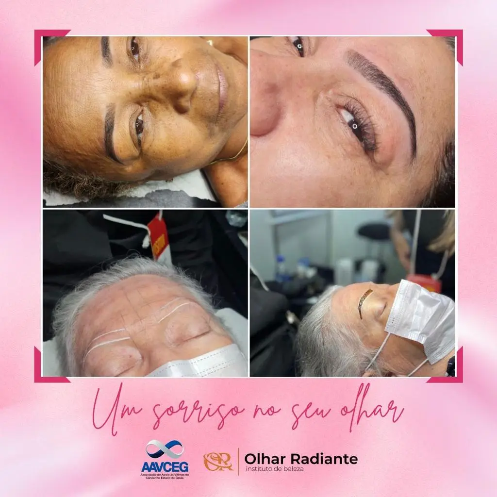 Resultados de tratamento facial